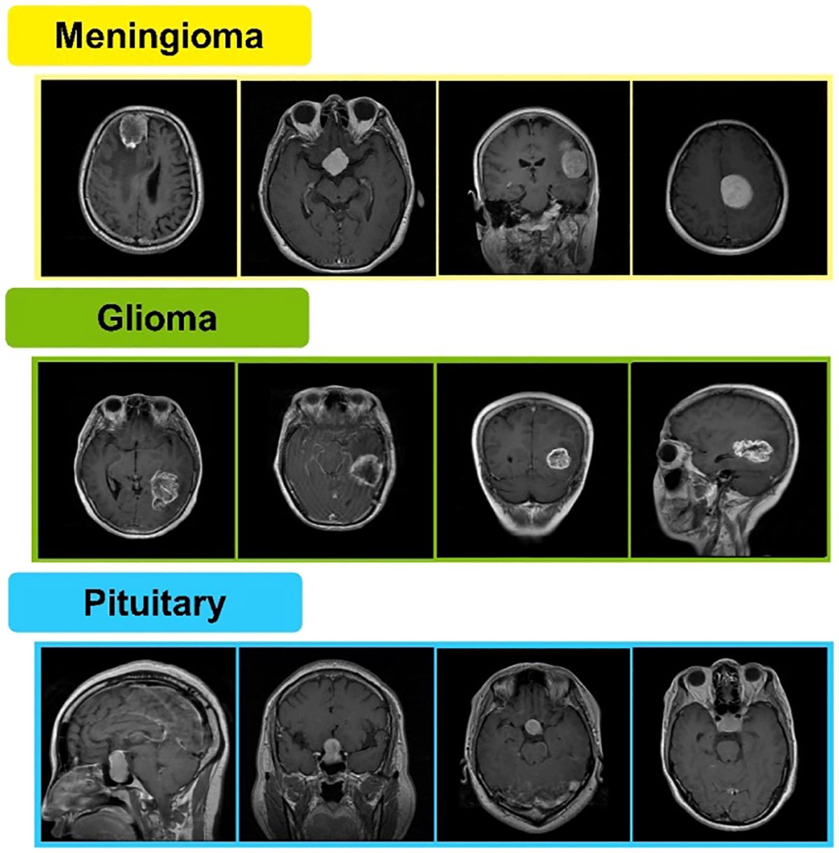ai in medical